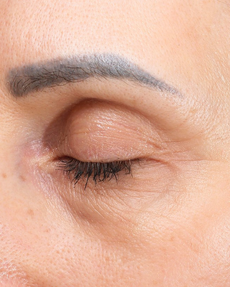 Crowe's Feet — After