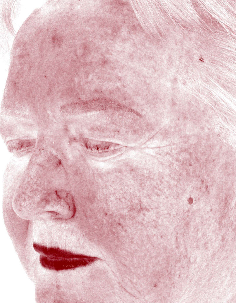 Redness — After