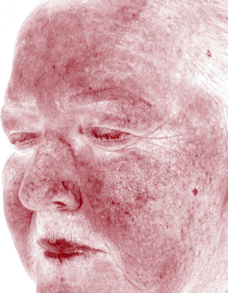 Redness — Before