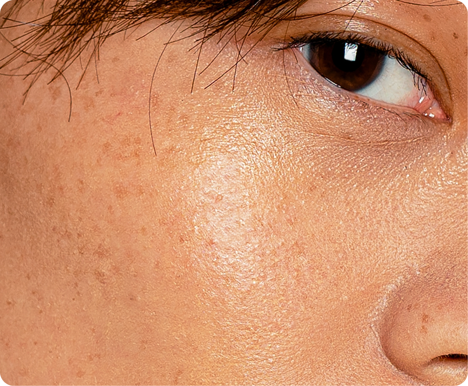 Skin Renewal