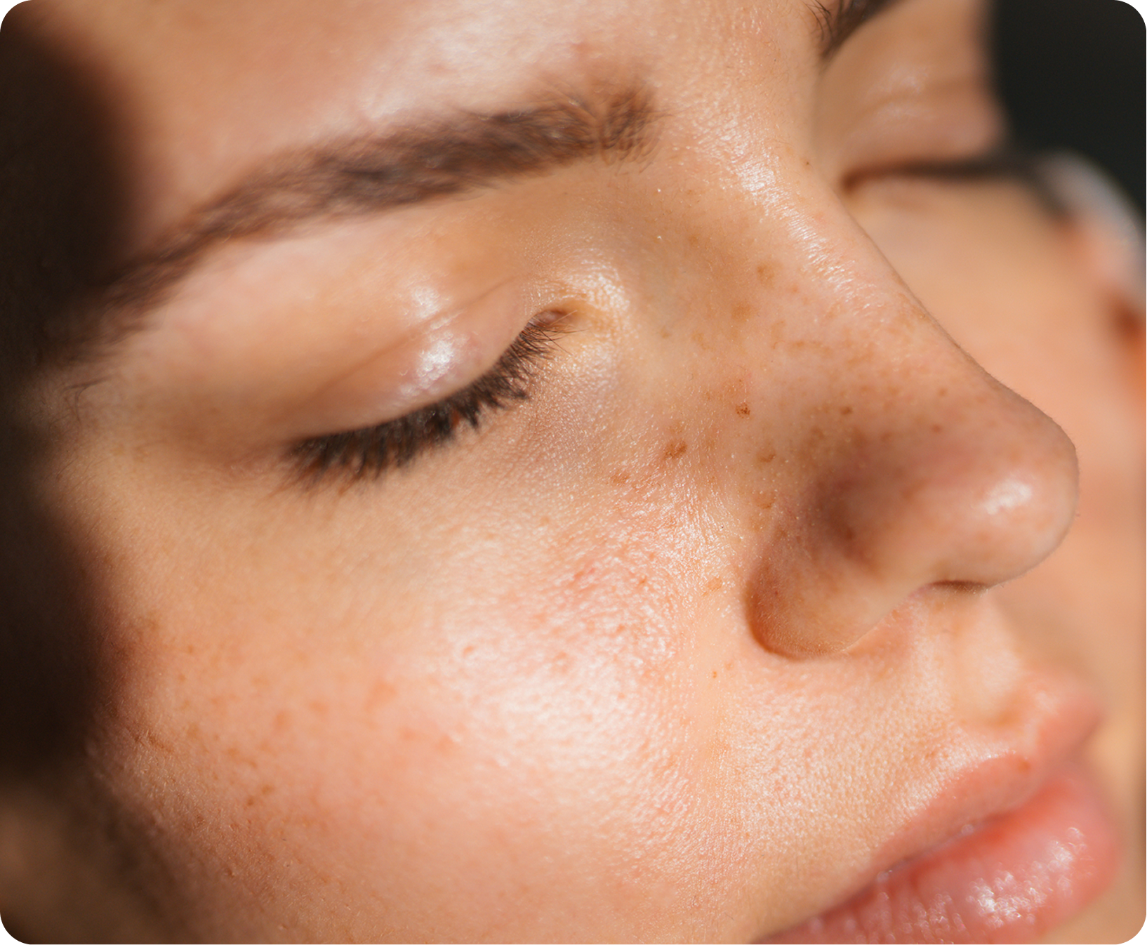 Skin Renewal