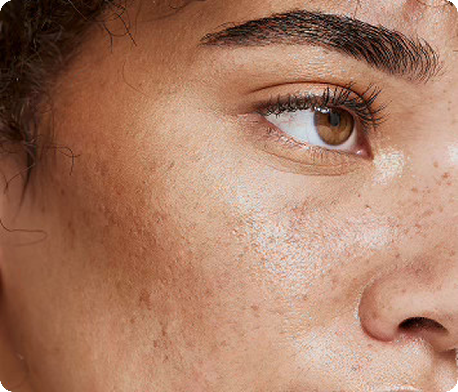 Skin Renewal